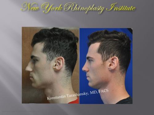 Slide3