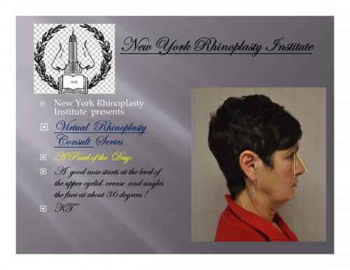 Virtual Consultation Series A pearl of the day-2