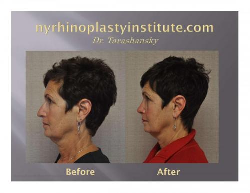Virtual Consultation Series A pearl of the day-5