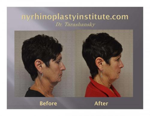 Virtual Consultation Series A pearl of the day-6